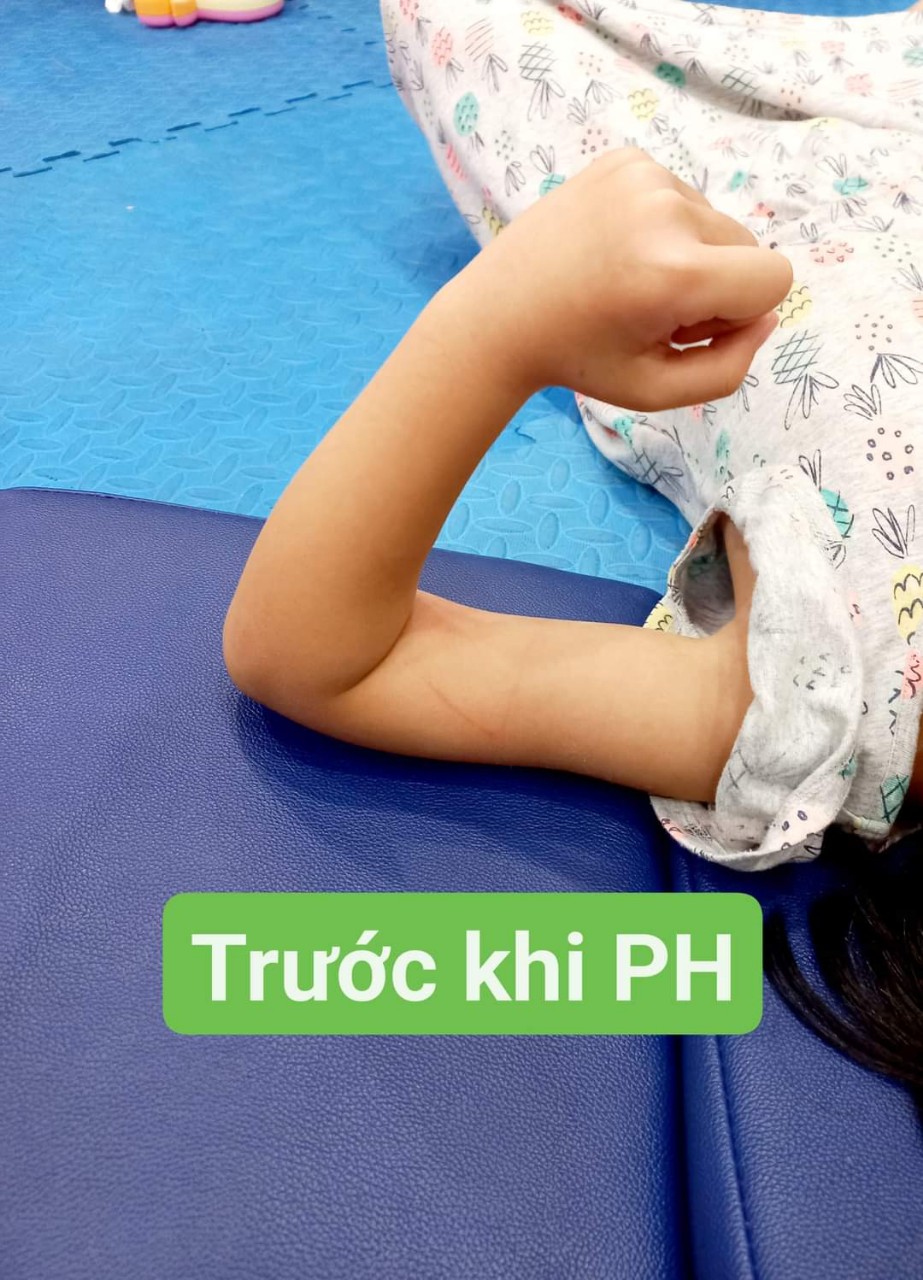 Trước khi tập PHCN